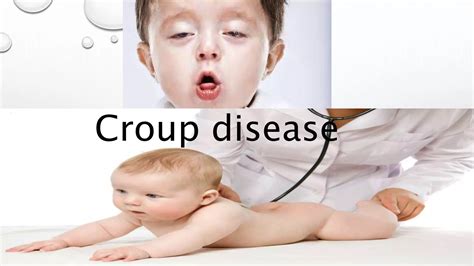 Croup disease | PPTX