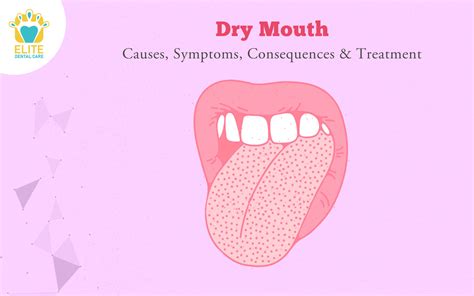 Xerostomia Pronunciation Cholinergic transmission and drugs