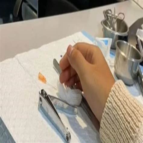 बर्तन धोते हुए नाखून में फंस गई सुखी सेवई, तुरंत करना पड़ा हॉस्पिटल में ...