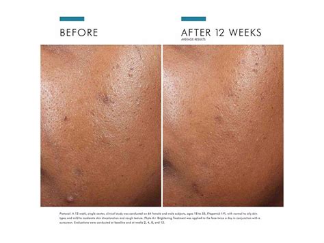 SkinCeuticals Phyto A+ Brightening Daily Moisturizer | LovelySkin