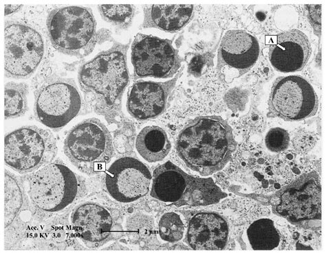 A Walk through Gumboro Disease