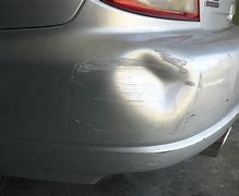 Image result for Dent Removal Tools