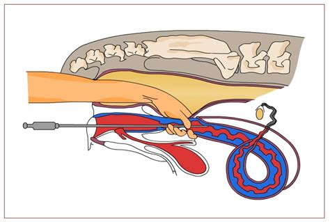 Artificial Insemination (AI) in Animals