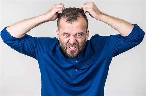 Best Hair Transplant Treatment in Gurgaon
