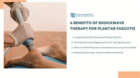 Shockwave Therapy For Plantar Fasciitis