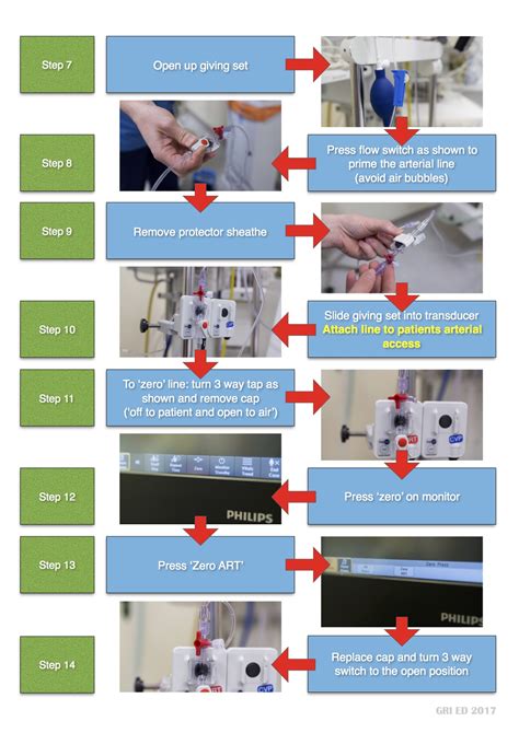 Image result for Arterial Line Procedure Note Template
