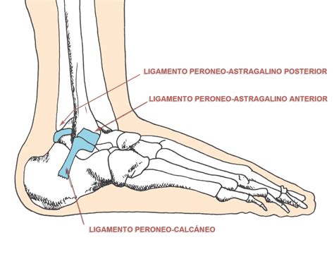 Esguince de tobillo: lesión y tratamiento - OsteoKids & Adults