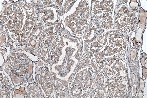 IHCeasy MTHFD1 Ready-To-Use IHC Kit KHC0578 | Proteintech