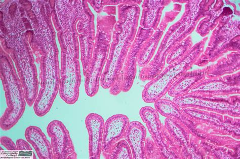 Image result for Small Intestine Epithelial Cells