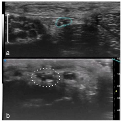 Clinical Application of Ultra-High-Frequency Ultrasound
