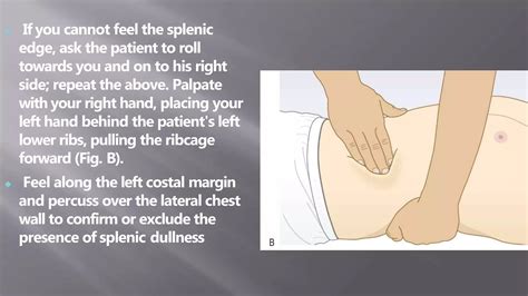 abdominal palpation.pptx