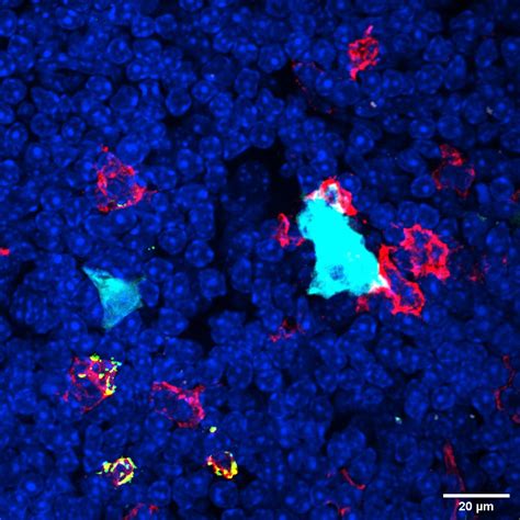 “Fascinating” Findings – Scientists Have Discovered a New Type of Immune Cell