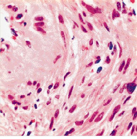 Spindle Shape 的图像结果