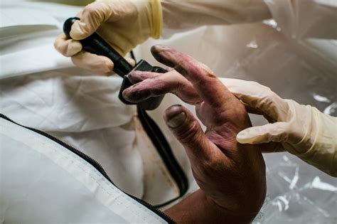 Image result for Compost Autopsy