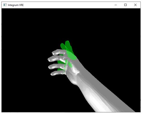 An Adaptive Multi-Modal Control Strategy to Attenuate the Limb Position ...