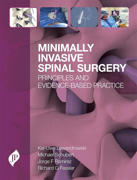 Buy Minimally Invasive Spinal Surgery: Principles and Evidence-Based ...