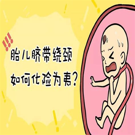 孕期的这些行为容易导致胎儿脐带绕颈，为了胎儿孕妈要杜绝