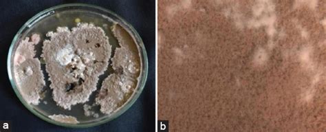 Genome mining and AntiSMASH analysis of an Endophytic Talaromyces sp ...