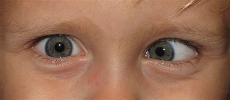 Our Services | Ophthalmology & Optical Centre Singapore | Eye Specialist Clinic