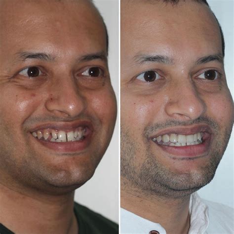 The Aligners Multispeciality Dental Hub, Viman Nagar, Pune