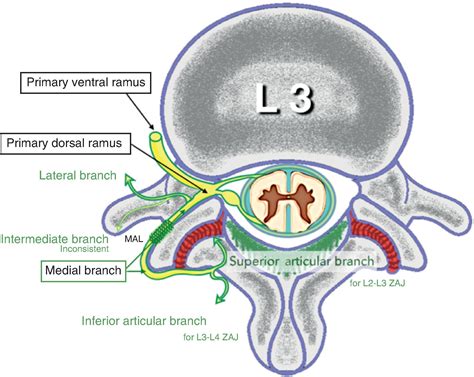 Facet Pain: Pathogenesis, Diagnosis, and Treatment - Clinical Tree