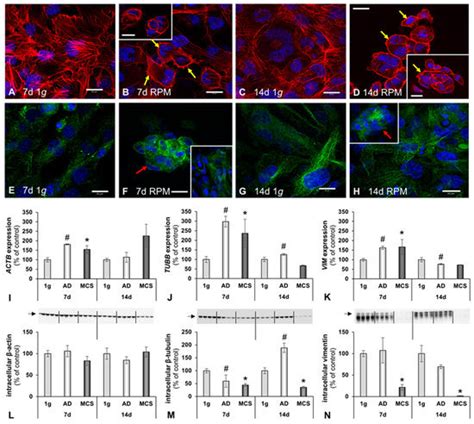 Changes in Human Foetal Osteoblasts Exposed to the Random Positioning ...