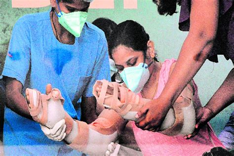 Train accident victim in Mumbai finds hand donor in Chennai