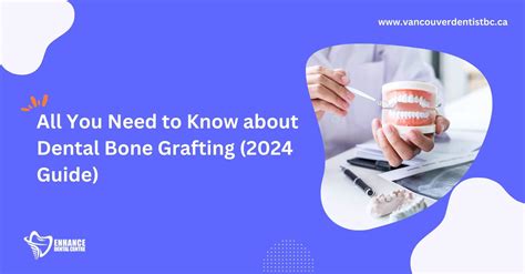 Image result for Recovery From Wisdom Tooth Extraction