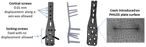 Biomechanical Behavior of a Variable Angle Locked Tibiotalocalcaneal ...