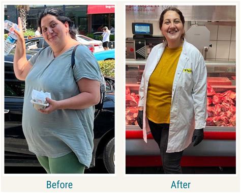 Gastric Bypass - iMed Medical