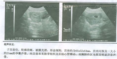 胎儿3个月、6个月、9个月的变化，看完惊喜又感动，你期待吗？ - 知乎