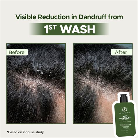 The Man Company Anti-Dandruff Shampoo | AHA & BHA Scalp Care