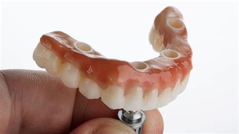 Image result for Dentures Look Real