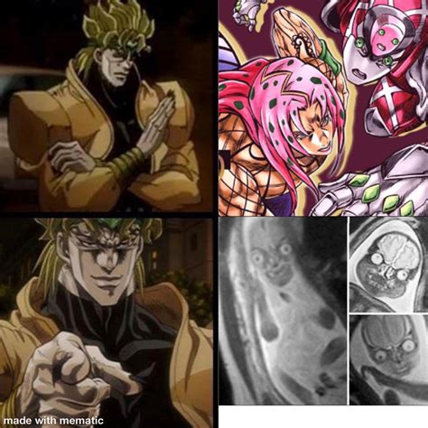 What happens when you get an MRI while pregnant? You get king crimson. U/Stand_u... | Know Your Meme