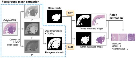 Two-Stage Classification Method for MSI Status Prediction Based on Deep ...