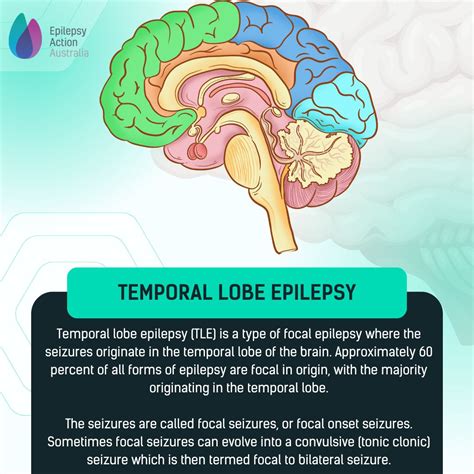 Temporal Lobe Seizure