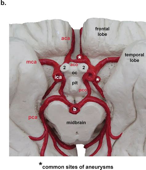 Anatomy Of The Circle Of Willis - circle of willis anatomy