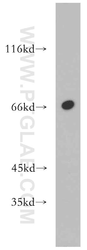MEF2C antibody (20326-1-AP) | Proteintech