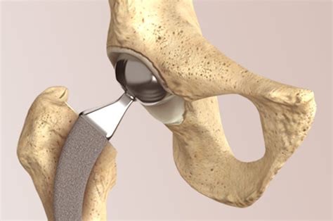 Orthopaedic Doctors in Ahmedabad | Assure Orthopaedic Hospital