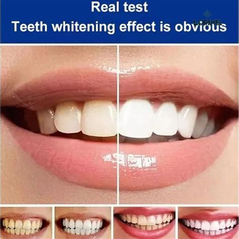 LORSHEL Sp 6 ultra toothpaste updated of sp 4 toothpasste teeth tooth ...