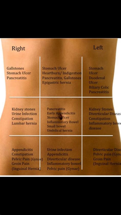 Abdominal pain chart | Medical school stuff, Nursing student tips ...