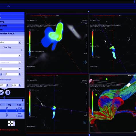 Image result for CFD Programs