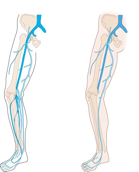 Slagter - Drawing Deep and superficial veins of the lower extremity ...