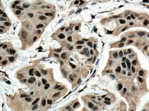 BAT1 antibody (67641-1-Ig) | Proteintech