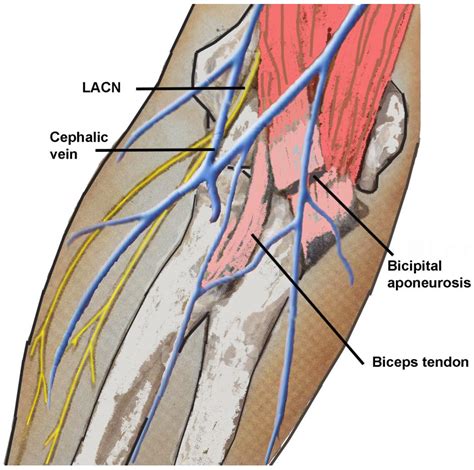 A Retrospective Study of Lateral Antebrachial Cutaneous Nerve ...