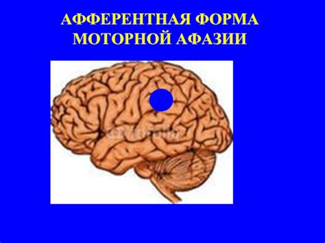 Афазия. Апраксия