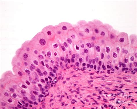 Transitional Epithelium Tissue