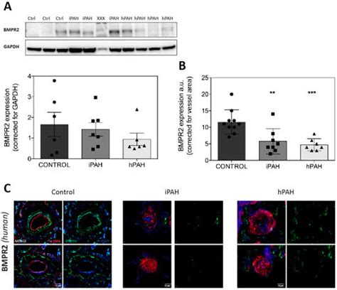 The BMP Receptor 2 in Pulmonary Arterial Hypertension: When and Where ...