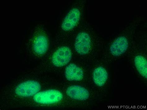 SKP2 antibody (15010-1-AP) | Proteintech