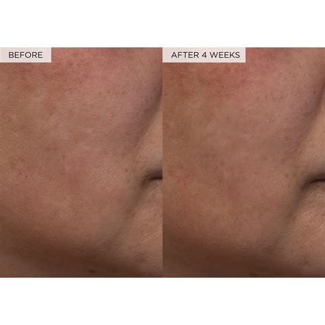 Glow Recipe PHA + BHA Face Toner - Facial Toner, India | Ubuy